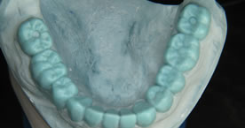 fixed orthotic treatment