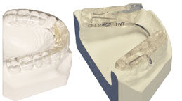 repositioning-splint