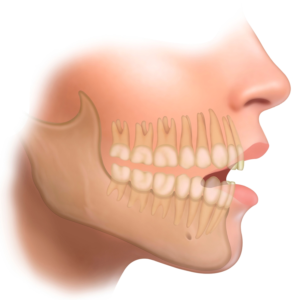 Illustration,Of,A,Female,Face,In,Profile,,Where,We,Can