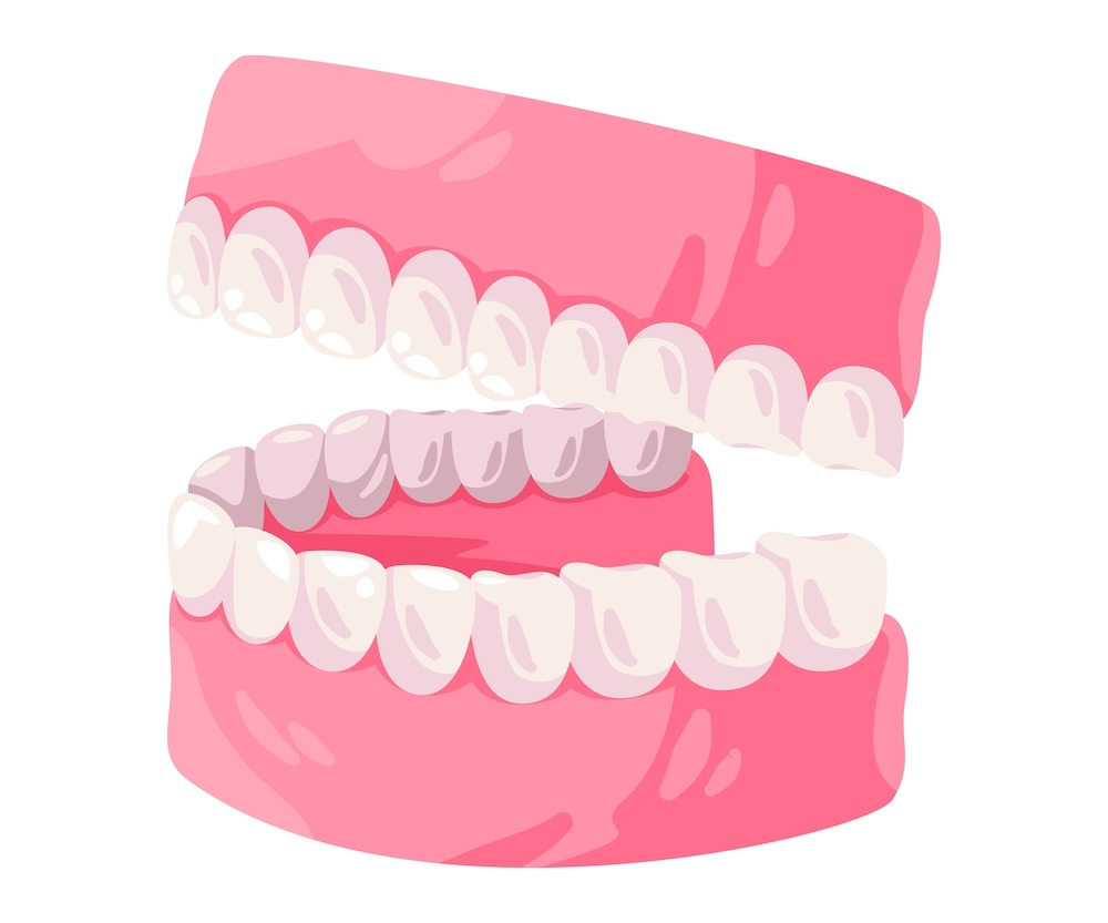 3d example of jaw